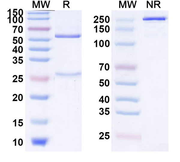 SDS-PAGE for Anti-Human Alpha-1-antitrypsin/SERPINA1 antibody (SAA2228)