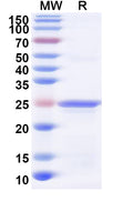 Recombinant Human GPX5 Protein, N-His