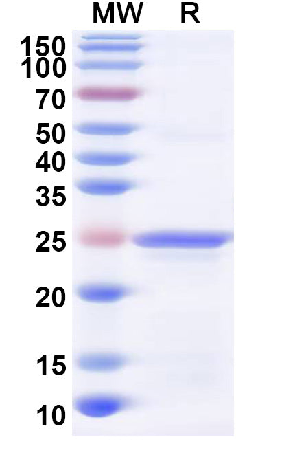 Recombinant Human GPX5 Protein, N-His