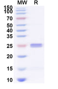 Recombinant Human CRTAM Protein, N-His