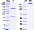 SDS-PAGE for Anti-Human CST3/Cys C Monoclonal Antibody (1A384)