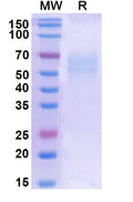 Recombinant Human CD358/TNFRSF21 Protein, C-His