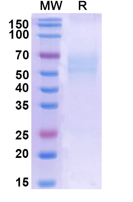 Recombinant Human CD358/TNFRSF21 Protein, C-His
