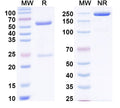 SDS-PAGE for Anti-Human C5/Complement C5 Antibody (SAA0831).