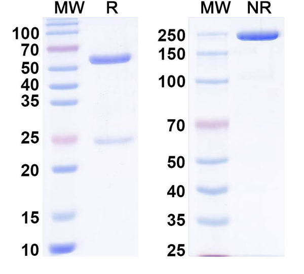 SDS-PAGE for Anti-Human C5/Complement C5 Antibody (SAA0831).