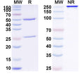 Anti-Human Complement C5 Reference Antibody (Ravulizumab) – Figure 1 of 2