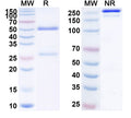 Anti-Human Complement C5 Reference Antibody (Tesidolumab) – Figure 1 of 2