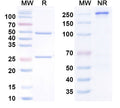 Anti-Human Complement C5 Reference Antibody (Pozelimab) – Figure 1 of 1