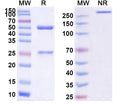 Anti-Human Complement C5 Reference Antibody (Vilobelimab) – Figure 1 of 1