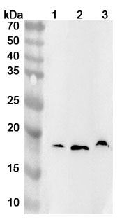 Western blot analysis was performed using anti-IL18BP polyclonal antibody at 1ug/mL on various samples.
Lane 1: U937 cell lysate
Lane 2: Mouse spleen lysate
Lane 3: Rat lung lysate