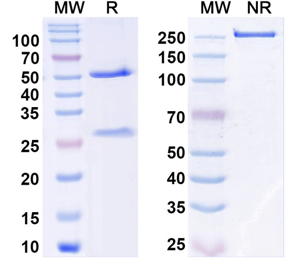 Flow-cytometry using anti-human CFD antibody.CFD Transfected CHO cells were stained with an irrelevant antibody (Blue Histogram) or an anti-human CFD antibody monoclonal antibody (Catalog # HF697010 ,Green Histogram) at a concentration of 5 µg/ml for 30 mins at RT. After washing, bound antibody was detected using a FITC conjugated goat anti-human antibody (Catalog # HF690414) and cells analysed on a NovoCyte Flow Cytometer.