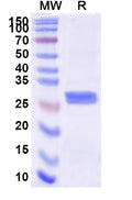 Recombinant Human CFD Protein, C-His