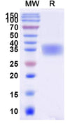 Recombinant Human EPO Protein, C-His