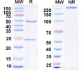 SDS-PAGE for Anti-ADAM11 Antibody (N441/26)