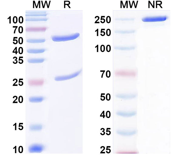 SDS-PAGE for Anti-Human BRD1 IP Antibody (SAA0189)