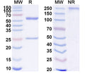 SDS-PAGE for Anti-Human BRD1 Antibody (SAA2120)