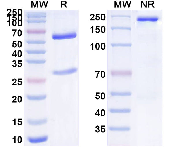 SDS-PAGE for Anti-Human CGA/CG-alpha Antibody (SAA1463)