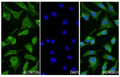 A549 cells were fixed with 4% paraformaldehyde for 20 minutes, followed by blocking with 5% goat serum for 1 hour. The cells were then incubated with a primary antibody targeting ALOX12B (HF742014) at a concentration of 28 ug/ml overnight at 4°C. Afterward, the cells were incubated with a secondary antibody, Goat Anti-Rabbit IgG (Alexa Fluor-488) for 50 minutes at room temperature. The localization of ALOX12B was visualized (shown in green), and nuclear DNA was stained with DAPI (shown in blue).