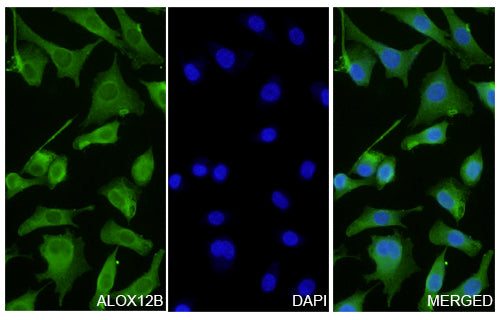 A549 cells were fixed with 4% paraformaldehyde for 20 minutes, followed by blocking with 5% goat serum for 1 hour. The cells were then incubated with a primary antibody targeting ALOX12B (HF742014) at a concentration of 28 ug/ml overnight at 4°C. Afterward, the cells were incubated with a secondary antibody, Goat Anti-Rabbit IgG (Alexa Fluor-488) for 50 minutes at room temperature. The localization of ALOX12B was visualized (shown in green), and nuclear DNA was stained with DAPI (shown in blue).