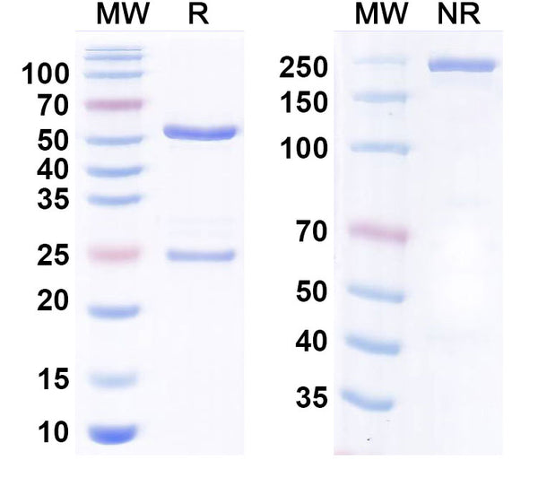 SDS-PAGE for Anti-Human TG/Thyroglobulin Monoclonal Antibody (1A305)