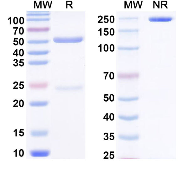 SDS-PAGE for Anti-Human TG/Thyroglobulin Antibody (SAA0535).