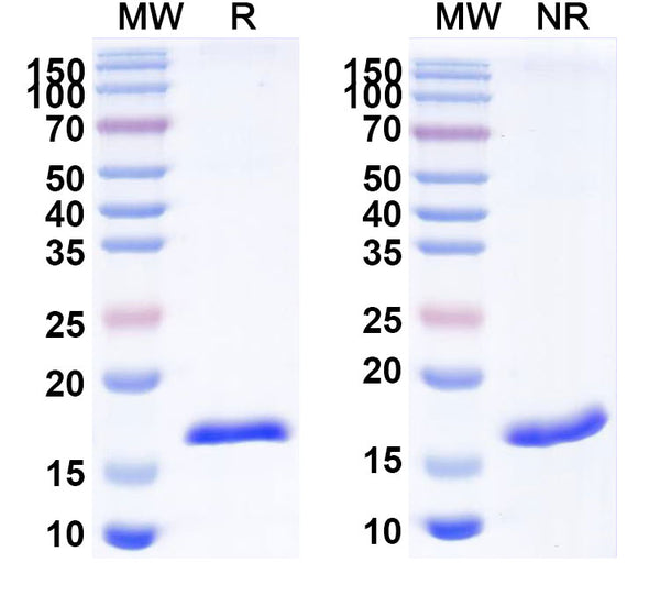 SDS-PAGE for Anti-Human TG/Thyroglobulin Nanobody (SAA1339)