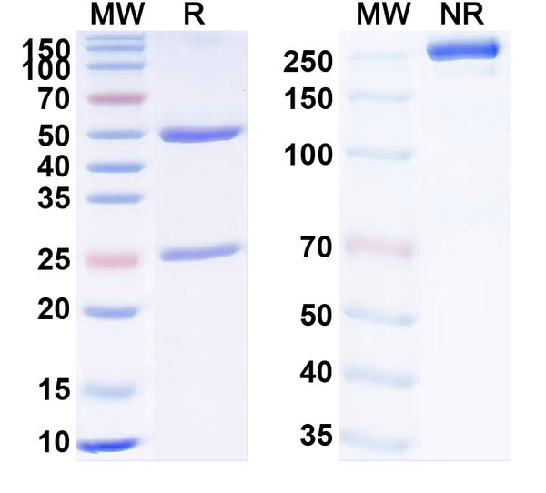 SDS-PAGE for Anti-Human BRD4 Antibody (SAA2122)