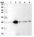 Western blot analysis was performed using anti-GGCT  polyclonal antibody at GGCT  on various samples.
Lane 1: Hela cell lysate
Lane 2: U937 cell lysate
Lane 3: Jurkat cell lysate
Lane 4: 293T  cell lysate
Lane 5: A549 cell lysate