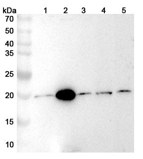 Western blot analysis was performed using anti-GGCT  polyclonal antibody at GGCT  on various samples.
Lane 1: Hela cell lysate
Lane 2: U937 cell lysate
Lane 3: Jurkat cell lysate
Lane 4: 293T  cell lysate
Lane 5: A549 cell lysate