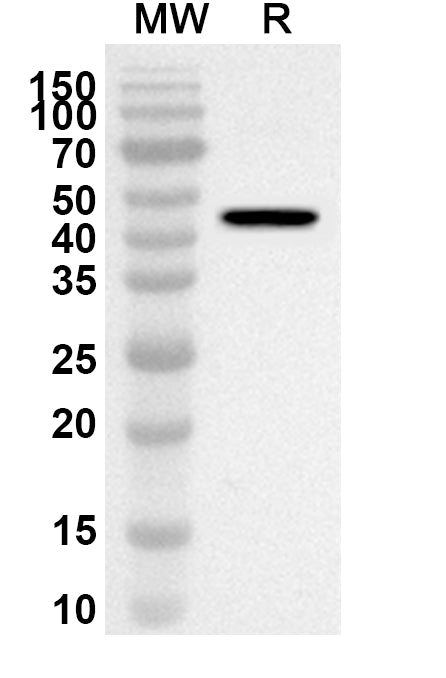 Western blot analysis was performed using anti-MFN2 polyclonal antibody at 1ug/mL on recombinant MFN2 (Catalog No. HF769012).