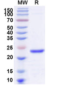 Recombinant Human DUSP11 Protein, N-His
