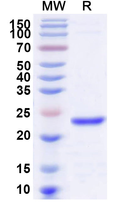Recombinant Human DUSP11 Protein, N-His