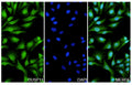 Hela cells were fixed with 4% paraformaldehyde for 20 minutes, followed by blocking with 5% goat serum for 1 hour. The cells were then incubated with a primary antibody targeting DUSP11 (HF776014) at a concentration of 38.4 ug/ml overnight at 4°C. Afterward, the cells were incubated with a secondary antibody, Goat Anti-Rabbit IgG (Alexa Fluor-488) for 50 minutes at room temperature. The localization of DUSP11 was visualized (shown in green), and nuclear DNA was stained with DAPI (shown in blue).