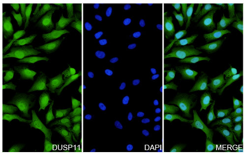 Hela cells were fixed with 4% paraformaldehyde for 20 minutes, followed by blocking with 5% goat serum for 1 hour. The cells were then incubated with a primary antibody targeting DUSP11 (HF776014) at a concentration of 38.4 ug/ml overnight at 4°C. Afterward, the cells were incubated with a secondary antibody, Goat Anti-Rabbit IgG (Alexa Fluor-488) for 50 minutes at room temperature. The localization of DUSP11 was visualized (shown in green), and nuclear DNA was stained with DAPI (shown in blue).