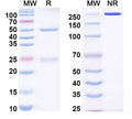 SDS-PAGE for Anti-Human TIMP1 Antibody (2PC10)