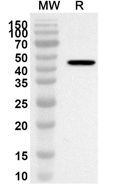 Western blot analysis was performed using anti-MB polyclonal antibody at 1ug/mL on recombinant MB (Catalog No. HF785012).