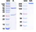 SDS-PAGE for Anti-Human MYO Monoclonal Antibody (1A338)