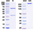 SDS-PAGE for Anti-Human LRP5/6 Antibody (SAA0791)