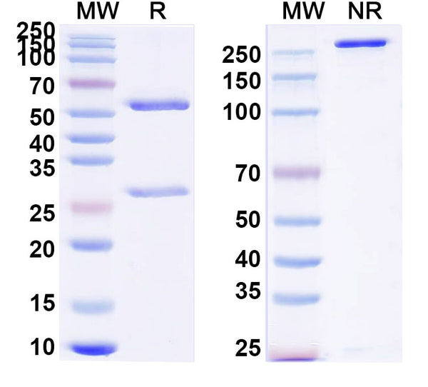 SDS-PAGE for Anti-Human LRP5/6 Antibody (SAA0791)