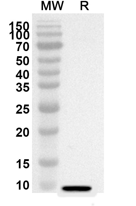 Western blot analysis was performed using anti-LRP5 polyclonal antibody at 1ug/mL on recombinant LRP5 (Catalog No. HF797012).