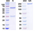SDS-PAGE for Anti-Human KDM4B IP Antibody (SAA0205)