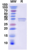 Recombinant Human FGA Protein, N-His