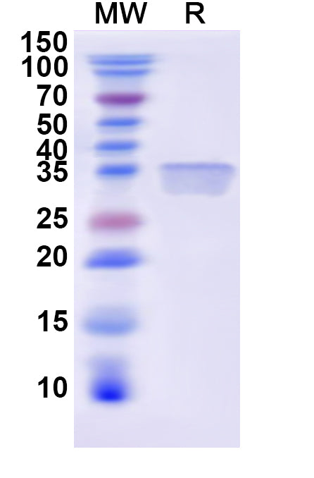 Recombinant Human FGA Protein, N-His