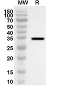 Western blot analysis was performed using anti-CS polyclonal antibody at 1ug/mL on recombinant CS (Catalog No. HF812012).