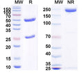 SDS-PAGE for Anti-Human IFNG/IFN-gamma Antibody (SAA0266).