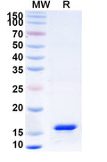 Recombinant Human IFNG/IFN-gamma Protein, N-His