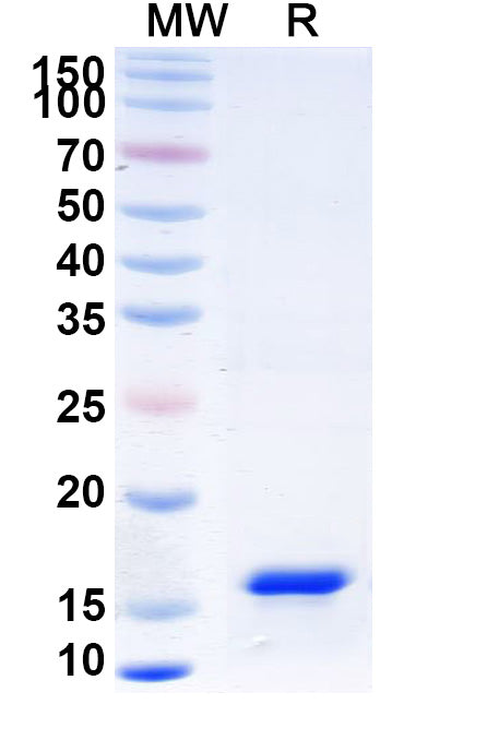 Recombinant Human IFNG/IFN-gamma Protein, N-His