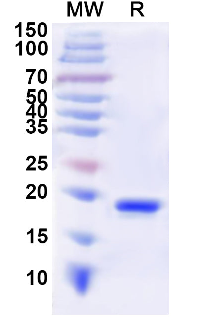 Recombinant Human CD8A Protein, N-His