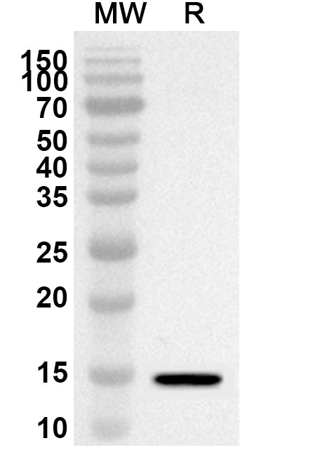 Western blot analysis was performed using anti-TSHB polyclonal antibody at 1ug/mL on recombinant TSHB (Catalog No. HF821012).