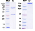 SDS-PAGE for Anti-Human Fibrin Antibody (59D8).